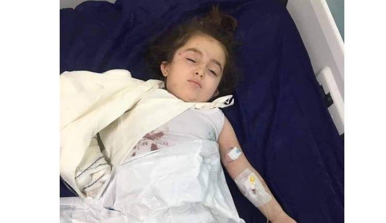 دب يهاجم طفلة في العراق ويكاد يبهر ذراعها
